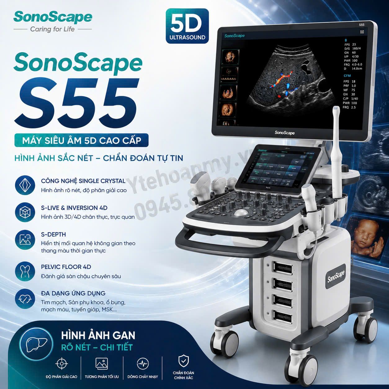 Tổng hợp các mẫu máy siêu âm 5D SonoScape đang được bán nhiều nhất tại Việt Nam